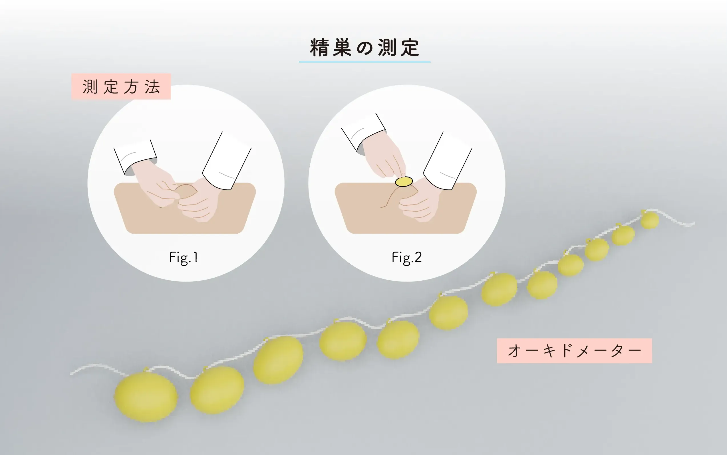 男性不妊症の診断に必要な検査